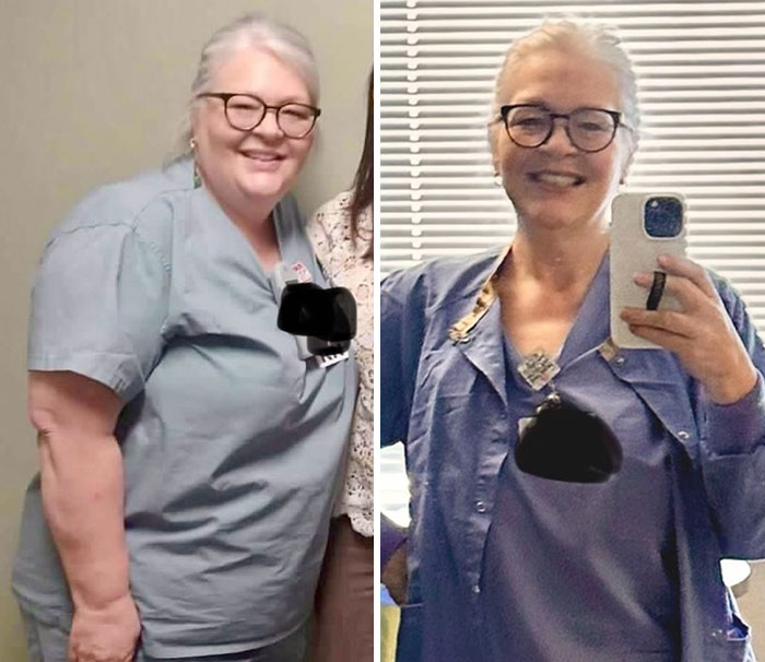 Wait, They Actually Shared Their Ozempic Face Transformations?!