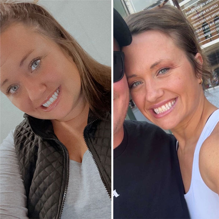 Wait, They Actually Shared Their Ozempic Face Transformations?!