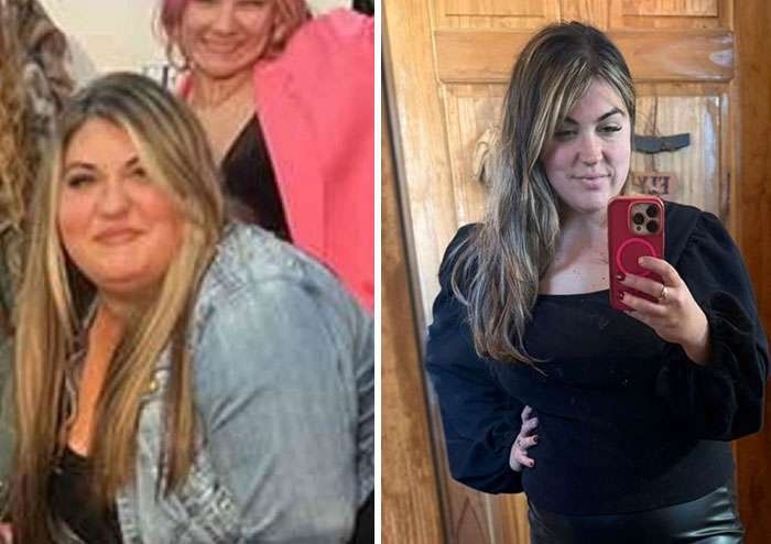 Wait, They Actually Shared Their Ozempic Face Transformations?!