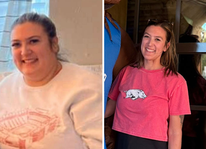 Wait, They Actually Shared Their Ozempic Face Transformations?!