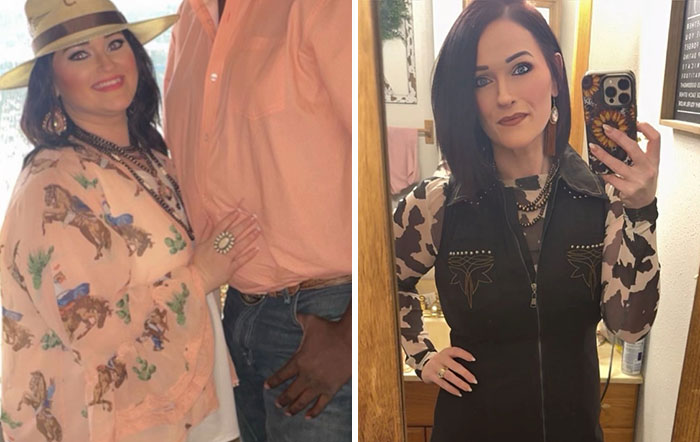 Wait, They Actually Shared Their Ozempic Face Transformations?!