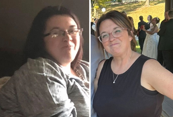 Wait, They Actually Shared Their Ozempic Face Transformations?!