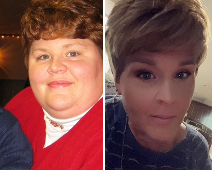 Wait, They Actually Shared Their Ozempic Face Transformations?!