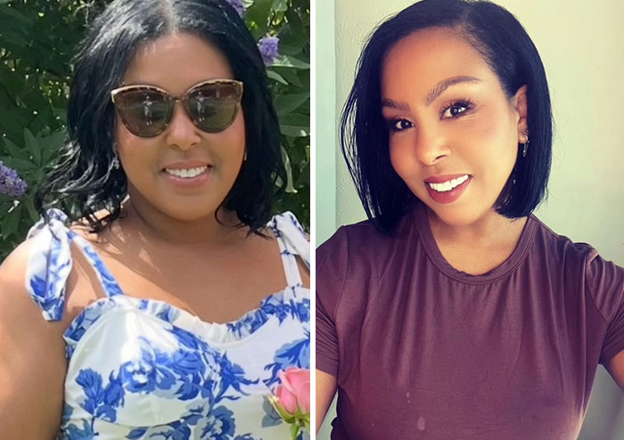 Wait, They Actually Shared Their Ozempic Face Transformations?!