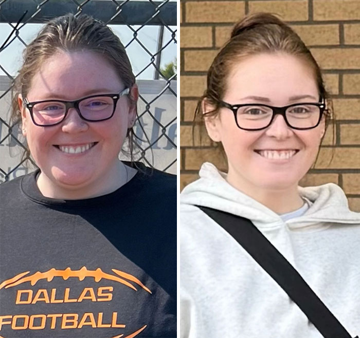 Wait, They Actually Shared Their Ozempic Face Transformations?!