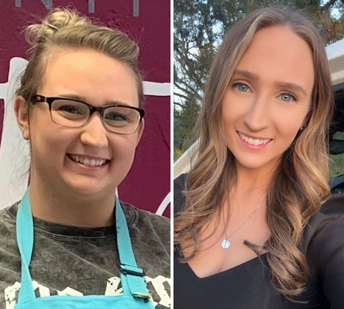 Wait, They Actually Shared Their Ozempic Face Transformations?!