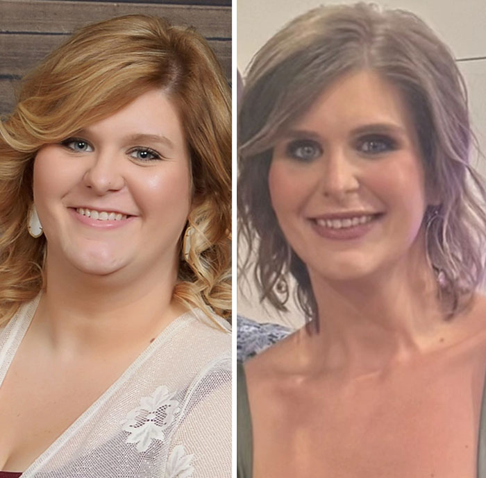 Wait, They Actually Shared Their Ozempic Face Transformations?!