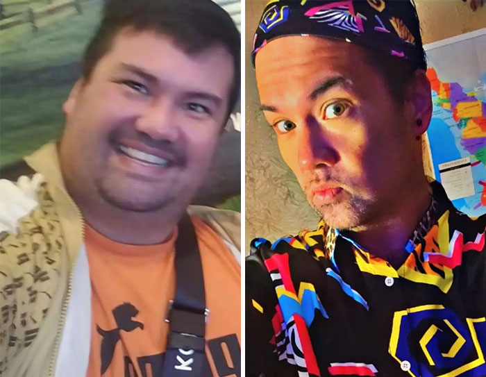 Wait, They Actually Shared Their Ozempic Face Transformations?!