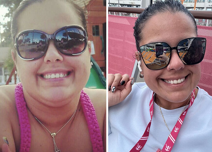 Wait, They Actually Shared Their Ozempic Face Transformations?!