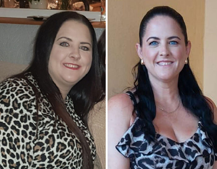 Wait, They Actually Shared Their Ozempic Face Transformations?!