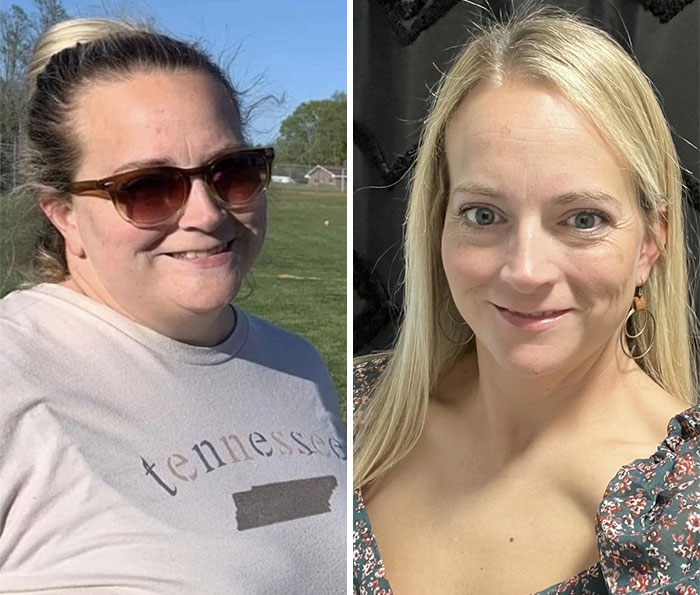 Wait, They Actually Shared Their Ozempic Face Transformations?!