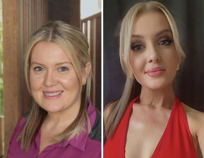 Wait, They Actually Shared Their Ozempic Face Transformations?!