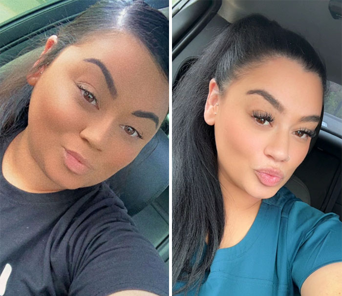 Wait, They Actually Shared Their Ozempic Face Transformations?!