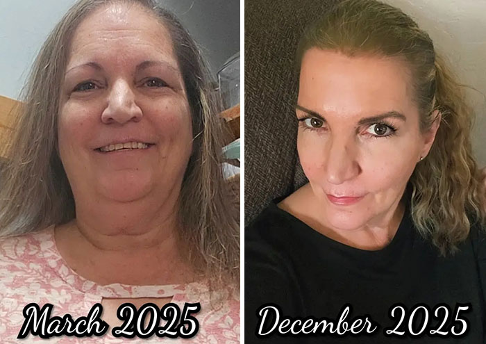 Wait, They Actually Shared Their Ozempic Face Transformations?!