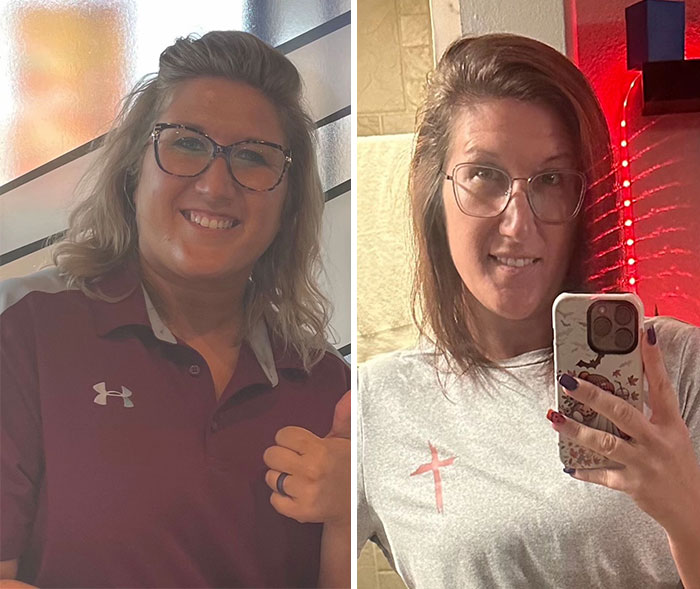 Wait, They Actually Shared Their Ozempic Face Transformations?!