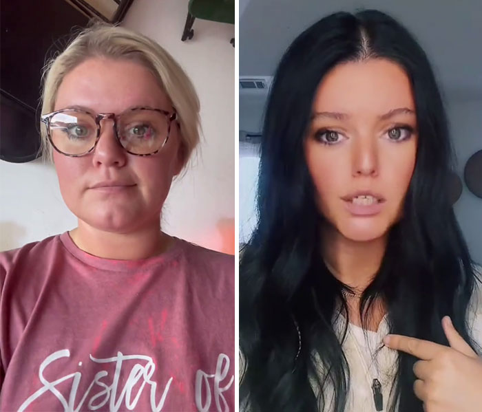 Wait, They Actually Shared Their Ozempic Face Transformations?!