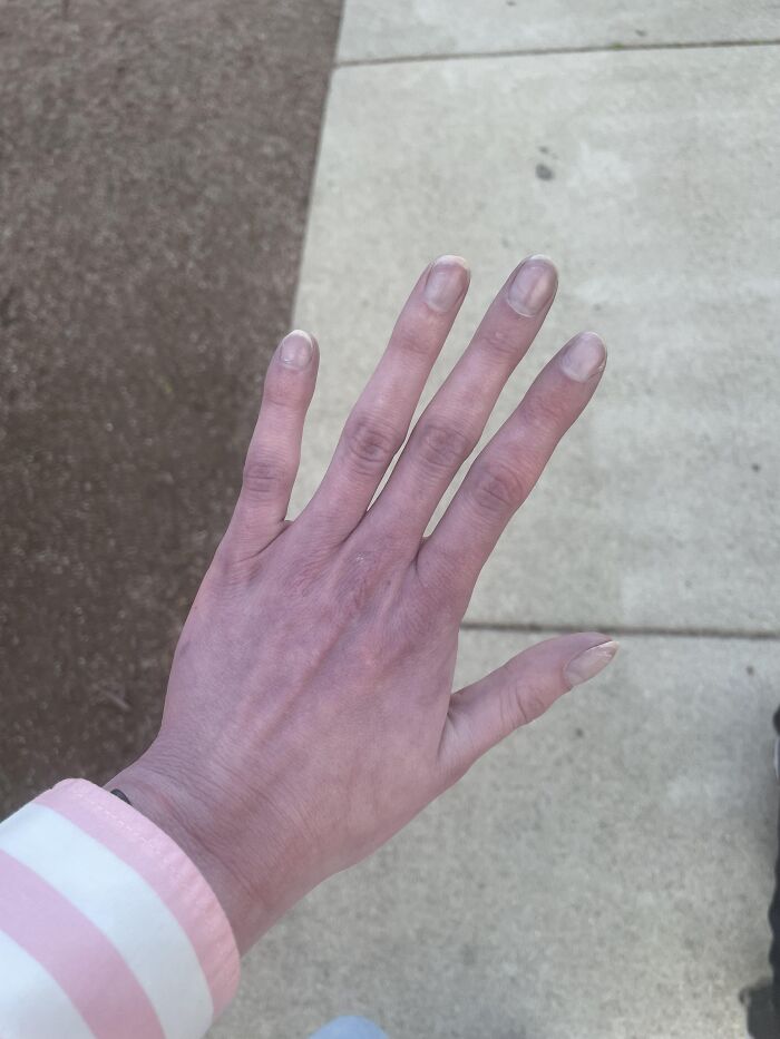 Wait, People Actually Went to the ER for This Stuff?!