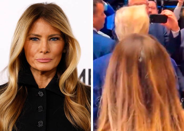 Melania Trump’s Hairline Goes Viral (Wait, Is That Real?)