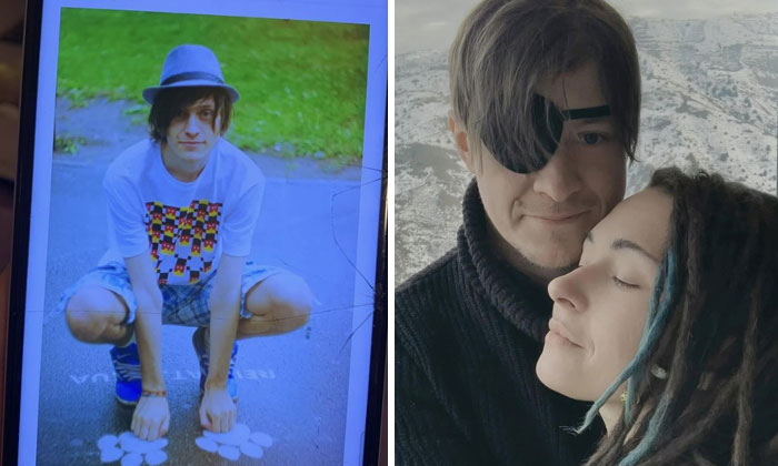 Wait, These Ukrainian Soldiers Shared Before-And-After Pics That’ll Totally Surprise You