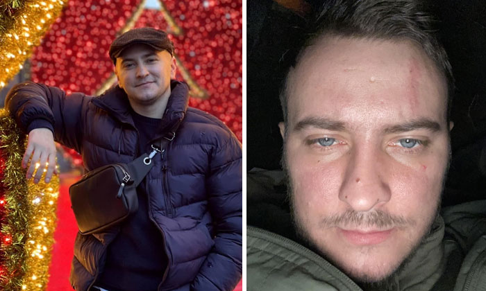 Wait, These Ukrainian Soldiers Shared Before-And-After Pics That’ll Totally Surprise You