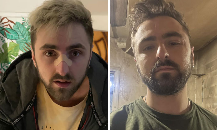 Wait, These Ukrainian Soldiers Shared Before-And-After Pics That’ll Totally Surprise You