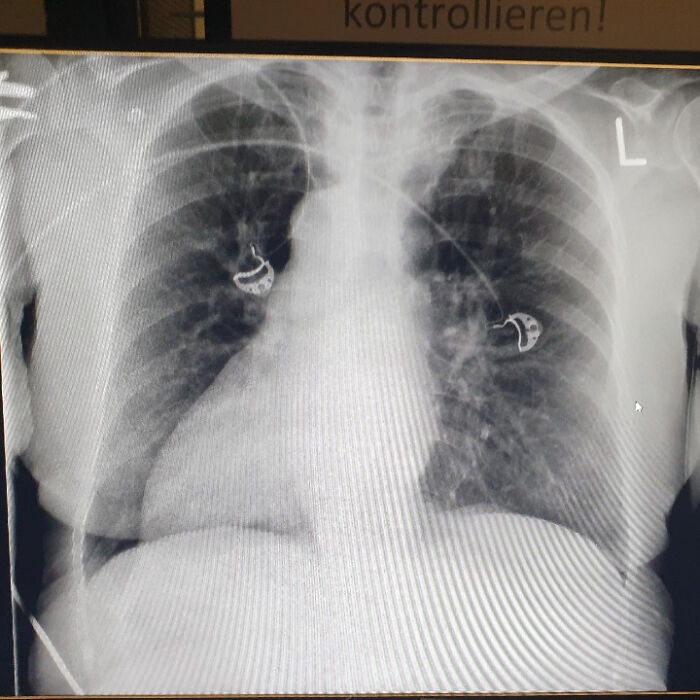 Wait, Autopsy Docs Are Sharing Their Wildest WTF Moments!