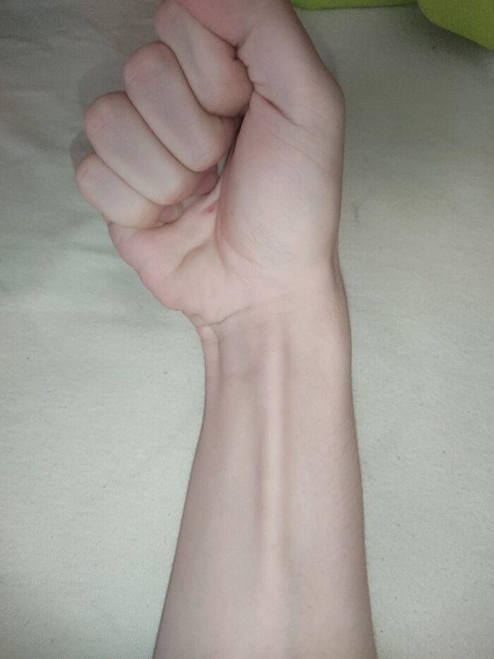 Wait, Autopsy Docs Are Sharing Their Wildest WTF Moments!