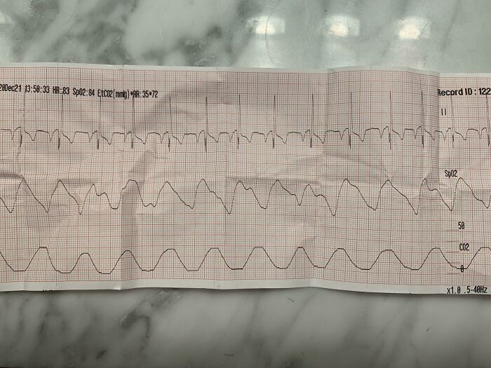 Wait, Autopsy Docs Are Sharing Their Wildest WTF Moments!