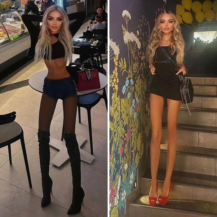 Legs For Days? More Like Legs For Eternity