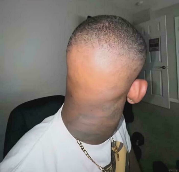 Oops! 78 Haircuts That Totally Took a Wrong Turn