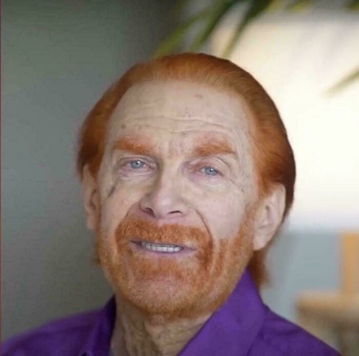 Oops! 78 Haircuts That Totally Took a Wrong Turn