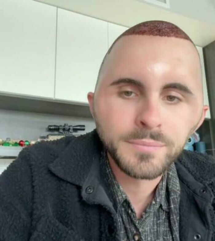 Oops! 78 Haircuts That Totally Took a Wrong Turn