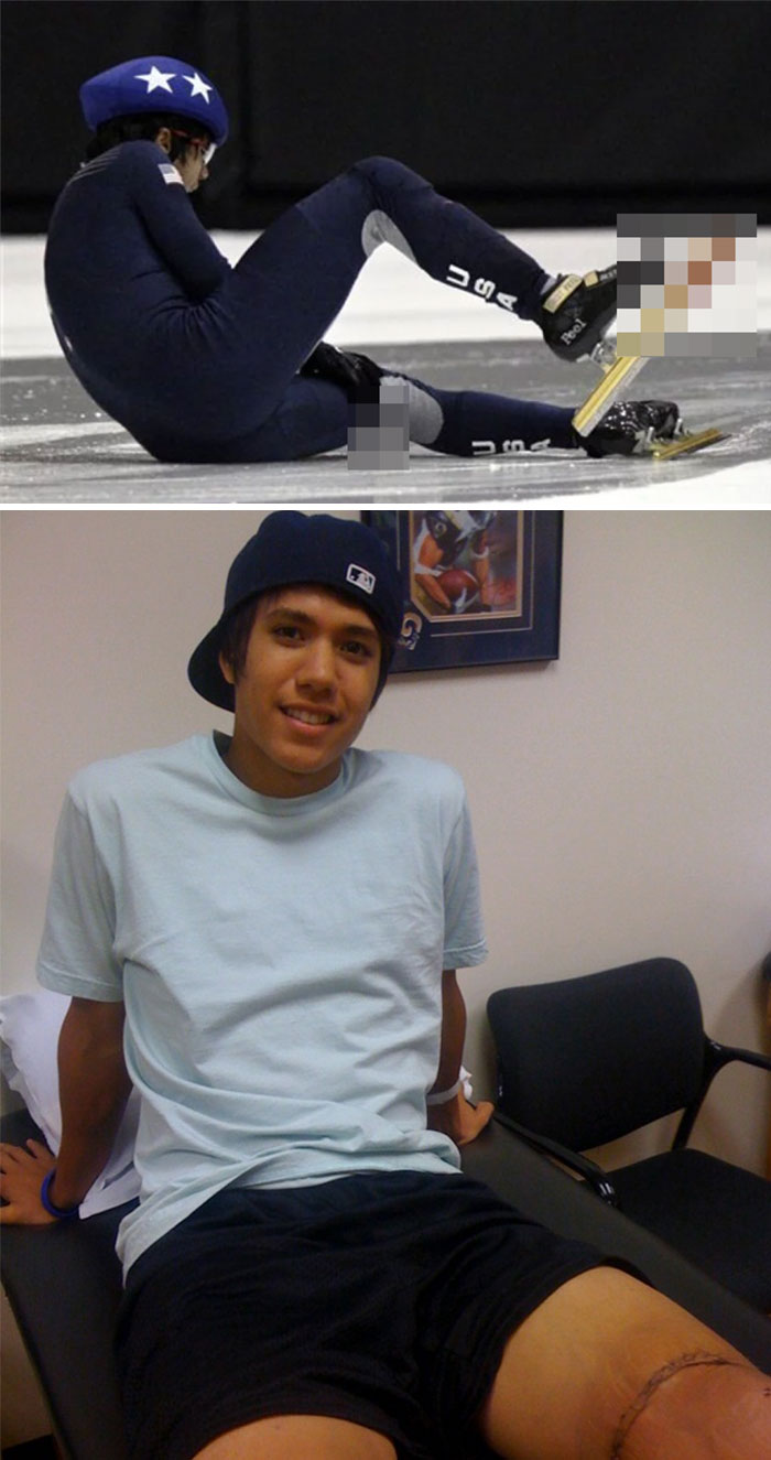 2009: J.R. Celski’s Skate Blade Disaster That Could’ve Ended Everything