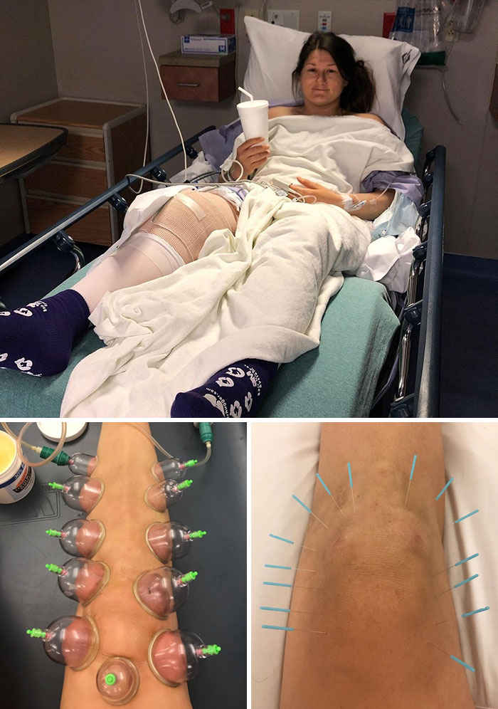 Devin Logan’s Knee Got a Makeover After Skiing Hurt For Years