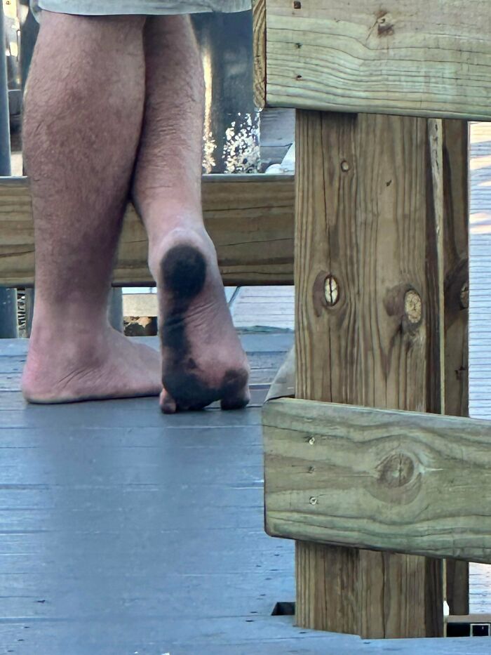 Wait, They Actually Snapped These Cringe Pics and We Can't Look Away!