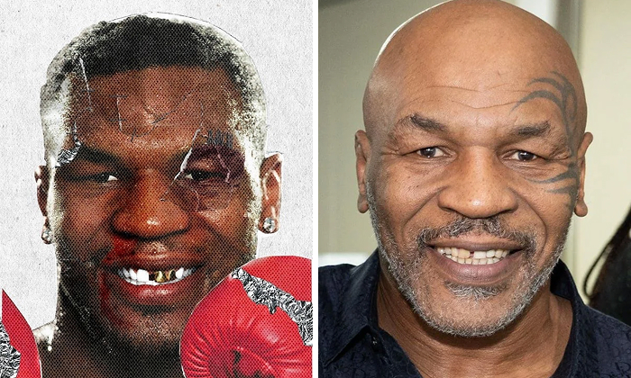 Mike Tyson