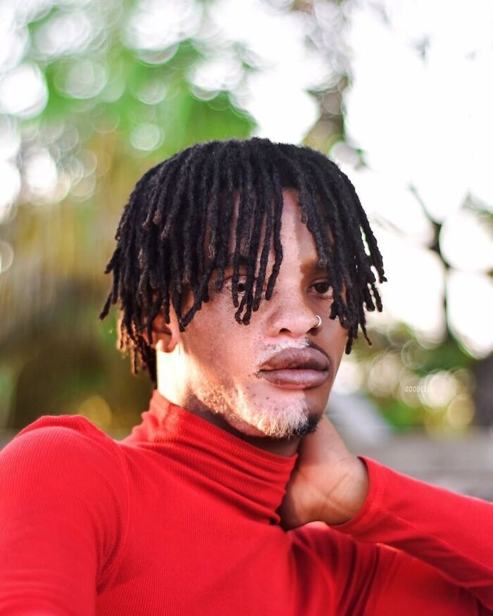 Wait, They Actually Made Vitiligo Look This Cool? 35 Pics That’ll Blow Your Mind