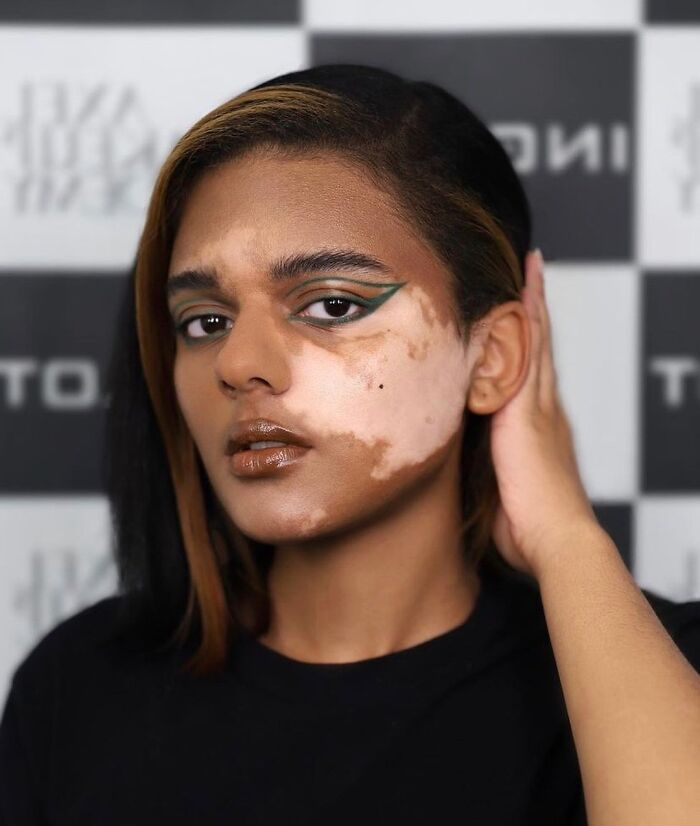 Wait, They Actually Made Vitiligo Look This Cool? 35 Pics That’ll Blow Your Mind