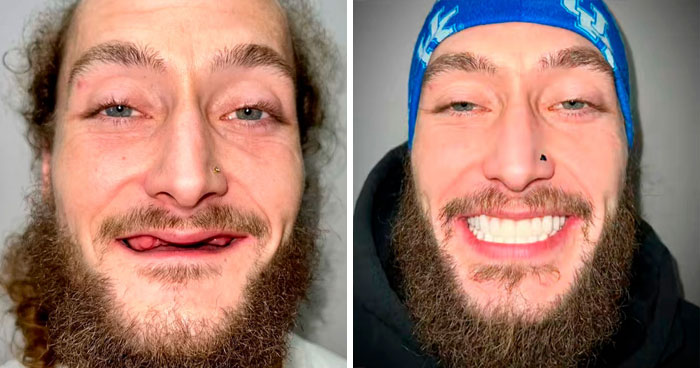 53 Dental Glow-Ups That Will Totally Make You Smile