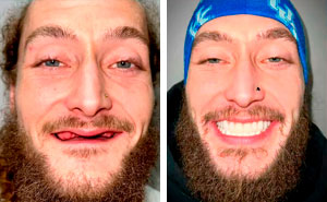 53 Dental Glow-Ups That Will Totally Make You Smile