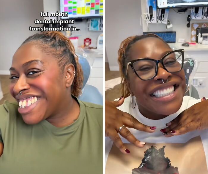 53 Dental Glow-Ups That Will Totally Make You Smile