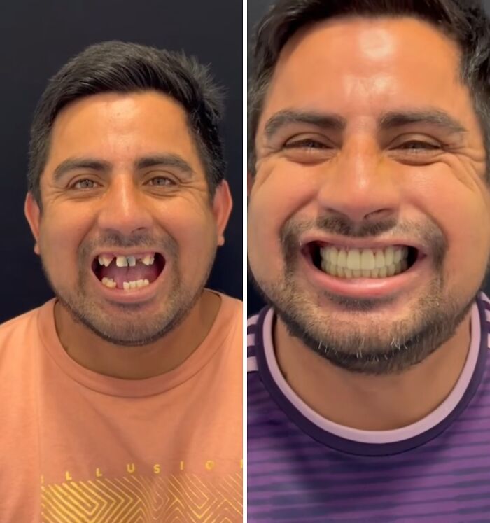 53 Dental Glow-Ups That Will Totally Make You Smile