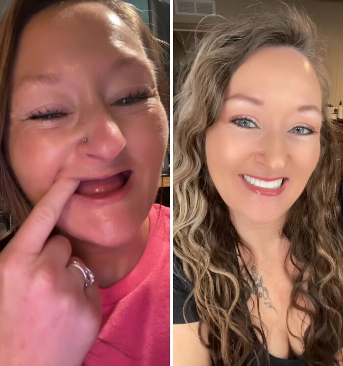 53 Dental Glow-Ups That Will Totally Make You Smile