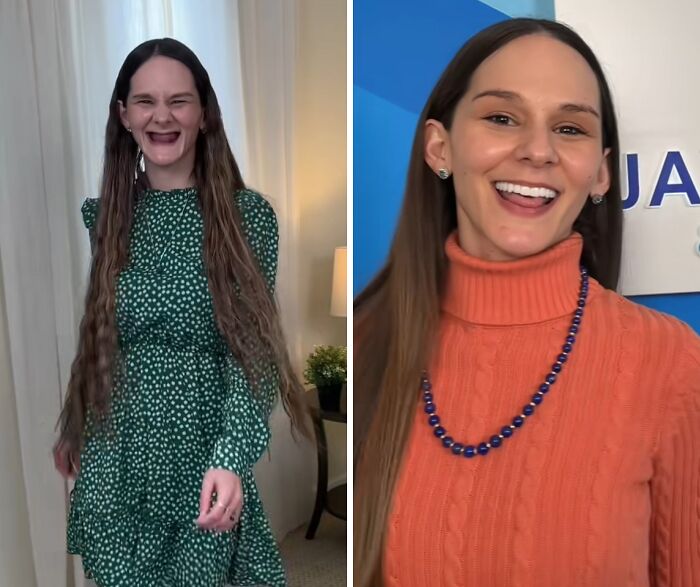 53 Dental Glow-Ups That Will Totally Make You Smile