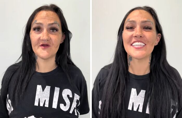 53 Dental Glow-Ups That Will Totally Make You Smile