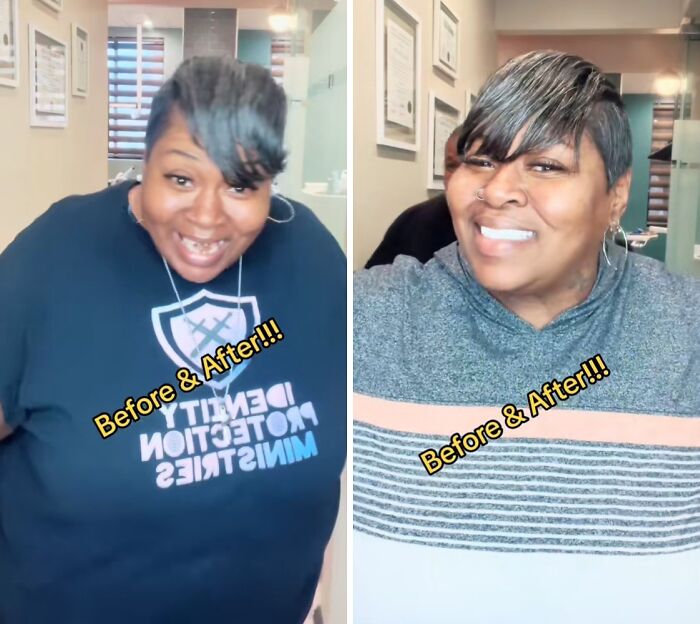 53 Dental Glow-Ups That Will Totally Make You Smile