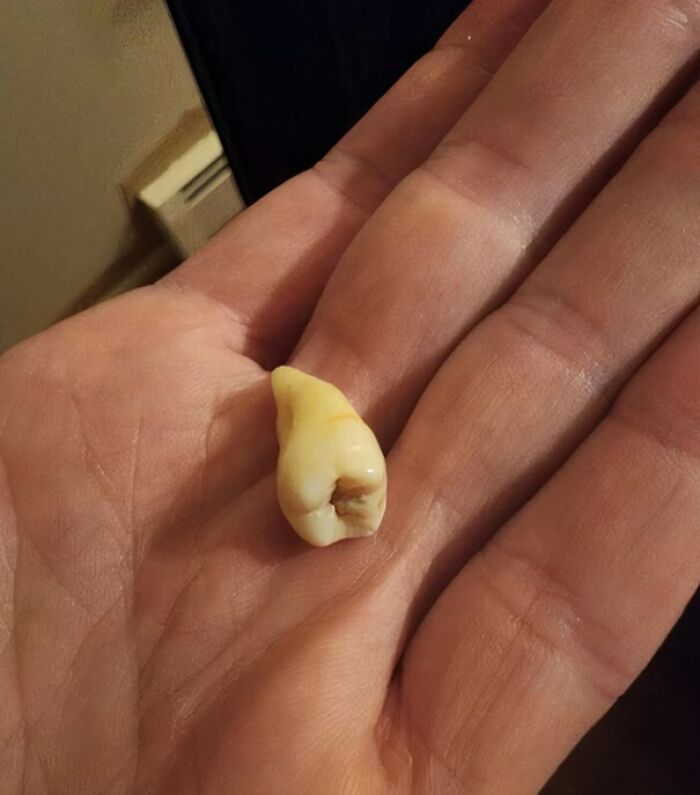 Since Moving In, I've Found FOUR Adult Teeth Just Lying Around. What’s Going On?!