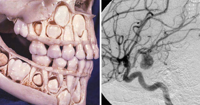 Wait, People Actually Shared The Creepiest Body Facts Ever?