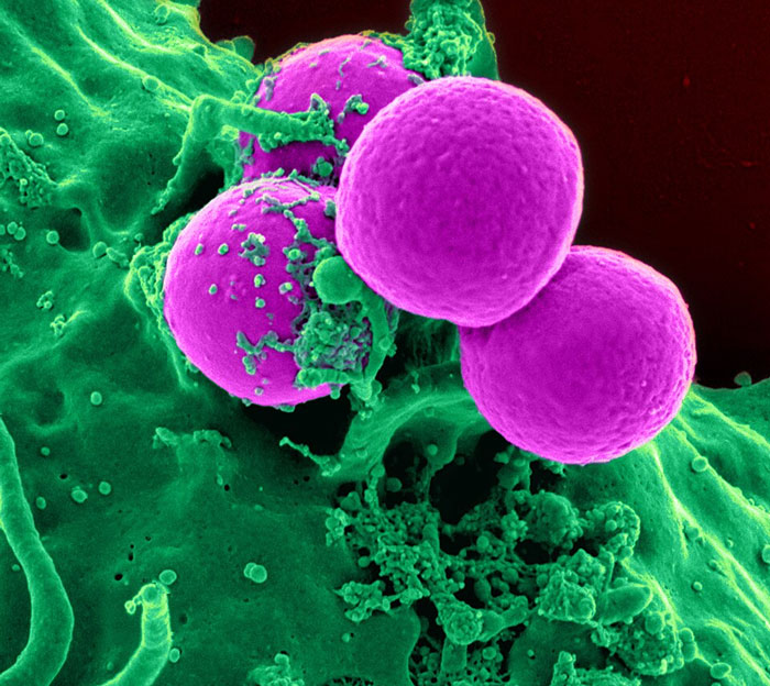 Wait, These Diseases Are Way Scarier Than You Think!