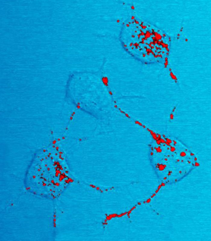 Wait, These Diseases Are Way Scarier Than You Think!